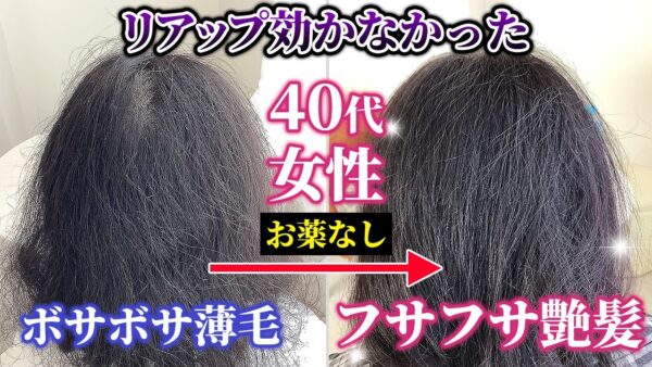 女性の薄毛が6ヶ月で改善！クセ毛まで治るスゴ技発毛術とは？！