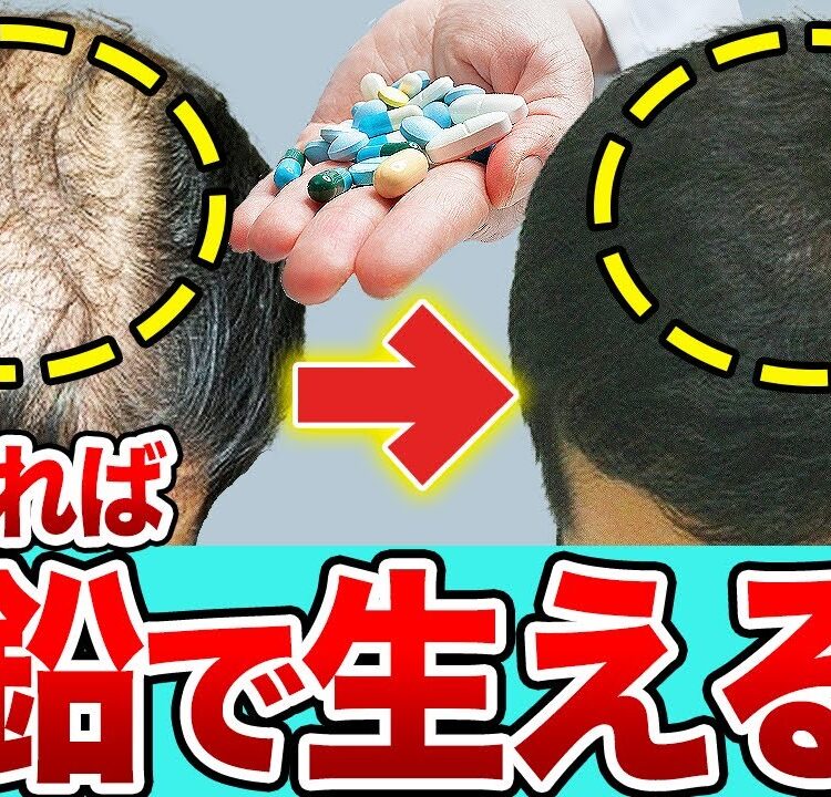 警告】亜鉛サプリでハゲる！？育毛に成功するための3つのポイント