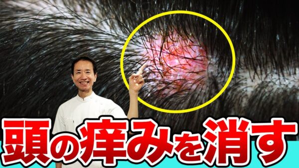 【頭皮湿疹に注意】脱毛のリスクも!? すぐに試せる改善策を紹介